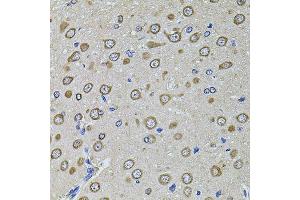 Immunohistochemistry of paraffin-embedded rat brain using EIF4A2 antibody (ABIN5972034) at dilution of 1/100 (40x lens). (EIF4A2 抗体)