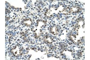 Glycoprotein antibody was used for immunohistochemistry at a concentration of 4-8 ug/ml to stain Alveolar cells (arrows) in Human Lung. (Glycoprotein 抗体)