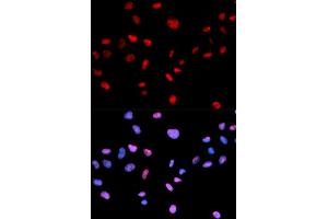 Immunofluorescence analysis of MCF-7 cells using Phospho-CDK1-T161 antibody (ABIN5969957). (CDK1 抗体  (pThr161))