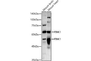 Western blot analysis of extracts of various cell lines, using PINK1 antibody (ABIN6128457, ABIN6145665, ABIN6145667 and ABIN6215214) at 1:1000 dilution. (PINK1 抗体  (AA 282-581))