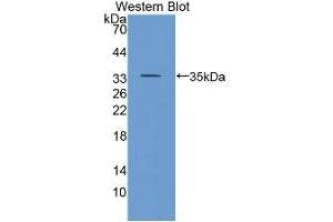 Detection of Recombinant CD24, Human using Polyclonal Antibody to Cluster Of Differentiation 24 (CD24) (CD24 抗体  (AA 27-80))