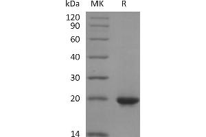Greater than 95 % as determined by reducing SDS-PAGE. (Sonic Hedgehog Protein (SHH) (His tag))