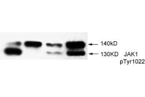Image no. 2 for anti-Janus Kinase 1 (JAK1) (pTyr1022) antibody (ABIN196869) (JAK1 抗体  (pTyr1022))