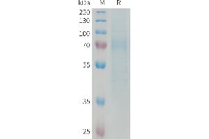Human R Protein, His Tag on SDS-PAGE under reducing condition. (RTN4R Protein (AA 27-447) (His tag))