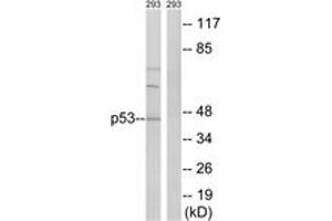 Western blot analysis of extracts from 293 cells, using p53 (Ab-387) Antibody. (p53 抗体  (AA 341-390))