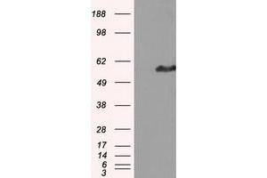 HEK293T cells were transfected with the pCMV6-ENTRY control (Left lane) or pCMV6-ENTRY IFT57 (Right lane) cDNA for 48 hrs and lysed. (IFT57 抗体)