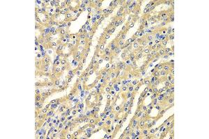 Immunohistochemistry of paraffin-embedded mouse kidney using WIPI2 antibody (ABIN5975599) at dilution of 1/100 (40x lens). (WIPI2 抗体)