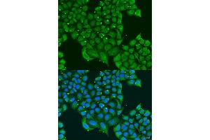 Immunofluorescence analysis of U2OS cells using ATPIF1 antibody. (ATPase Inhibitory Factor 1 抗体  (AA 26-106))
