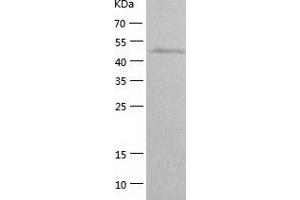 Western Blotting (WB) image for Enolase 3 (Beta, Muscle) (ENO3) (AA 1-434) protein (His tag) (ABIN7122789) (ENO3 Protein (AA 1-434) (His tag))