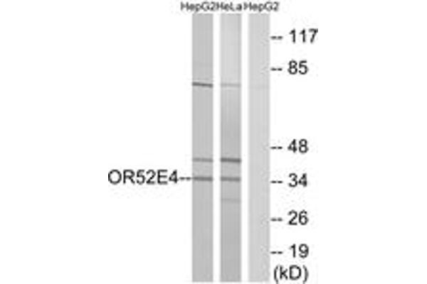OR52E4 抗体  (AA 200-249)