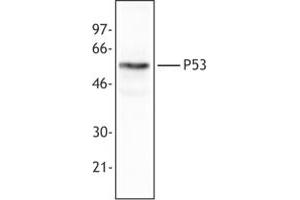 Image no. 1 for anti-Tumor Protein P53 (TP53) (AA 20-25) antibody (ABIN205508) (p53 抗体  (AA 20-25))