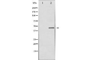 Western blot analysis of p70 S6 Kinase beta expression in 293 whole cell lysates,The lane on the left is treated with the antigen-specific peptide. (RPS6KB2 抗体  (C-Term))