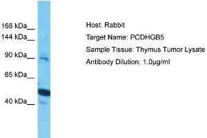 Host: Rabbit Target Name: PCDHGB5 Sample Type: Thymus Tumor lysates Antibody Dilution: 1. (PCDHGB5 抗体  (Middle Region))