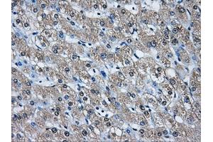 Immunohistochemistry (IHC) image for anti-Aldo-Keto Reductase Family 1, Member A1 (Aldehyde Reductase) (AKR1A1) antibody (ABIN1496544) (AKR1A1 抗体)