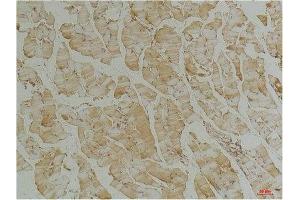 Immunohistochemical analysis of paraffin-embedded Mouse Skeletal Muscle Tissue using Desmin(mAb diluted at 1:200. (Desmin 抗体)