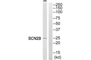 Western blot analysis of extracts from 293 cells, using SCN2B antibody. (SCN2B 抗体  (Internal Region))
