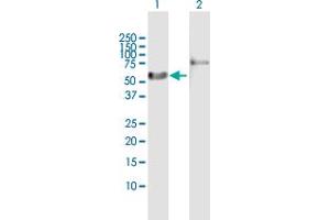 Western Blot analysis of RARA expression in transfected 293T cell line by RARA MaxPab polyclonal antibody. (Retinoic Acid Receptor alpha 抗体  (AA 1-462))