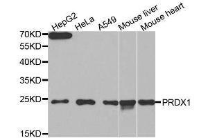 Western blot analysis of extracts of various cell lines, using PRDX1 antibody. (Peroxiredoxin 1 抗体  (AA 1-199))