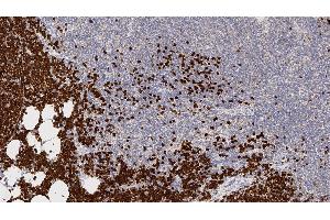 Human thymus: immunohistochemical staining for Terminal Deoxynucleotidyl Transferase. (TdT 抗体  (N-Term))