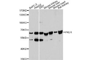 Western blot analysis of extracts of various cell lines, using PKLR antibody. (PKLR 抗体)