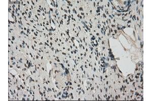 Immunohistochemical staining of paraffin-embedded colon tissue using anti-FERMT2mouse monoclonal antibody. (FERMT2 抗体)