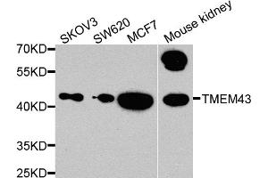 Western blot analysis of extracts of various cell lines, using TMEM43 antibody. (TMEM43 抗体)