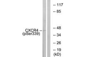 Western blot analysis of extracts from HuvEc cells treated with etoposide 25uM 24H, using CXCR4 (Phospho-Ser339) Antibody. (CXCR4 抗体  (pSer339))