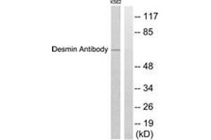 Western blot analysis of extracts from K562 cells, using Desmin Antibody. (Desmin 抗体  (AA 421-470))