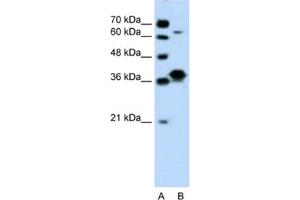 Western Blotting (WB) image for anti-FOS-Like Antigen 1 (FOSL1) antibody (ABIN2460206) (FOSL1 抗体)