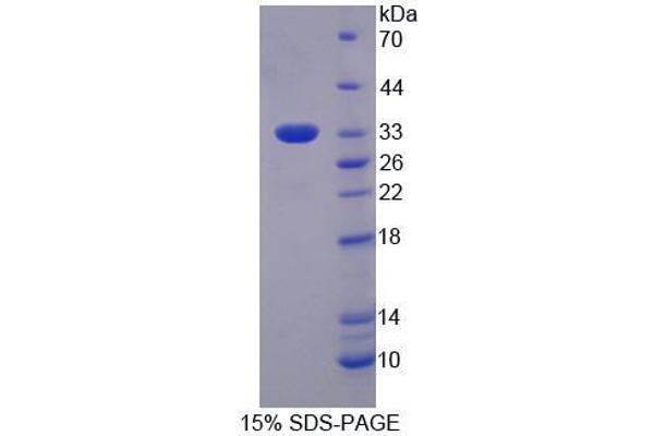 Eukaryotic Translation Initiation Factor 3, Subunit M (EIF3M) (AA 2-251) protein (His tag)