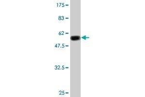 Western Blot detection against Immunogen (51. (TK1 抗体  (AA 1-234))