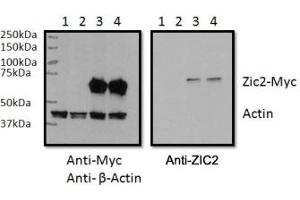 RWPE1 cell lysate overexpressing human ZIC2-MYC tag tested with ZIC2 antibody (0. (ZIC2 抗体)