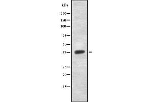 Western blot analysis of NDUFAF1 using Jurkat whole  lysates. (NDUFAF1 抗体  (N-Term))