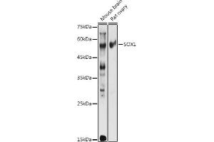 Western blot analysis of extracts of various cell lines, using SOX1 antibody (ABIN3017344, ABIN3017345, ABIN3017346 and ABIN1682856) at 1:1000 dilution. (SOX1 抗体)