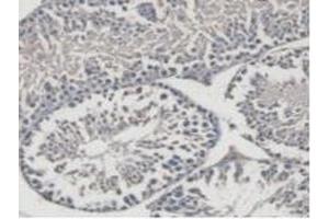 Immunohistochemistry (IHC) image for anti-Mitofusin 1 (MFN1) (AA 1-234) antibody (ABIN5013951)