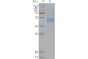 Human CM-Nanodisc, Flag Tag on SDS-PAGE (CMKLR1 蛋白)