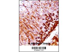Mouse Nek5 Antibody immunohistochemistry analysis in formalin fixed and paraffin embedded mouse stomach tissue followed by peroxidase conjugation of the secondary antibody and DAB staining. (NEK5 抗体  (C-Term))
