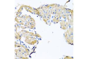 Immunohistochemistry of paraffin-embedded mouse heart using GPLD1 antibody. (GPLD1 抗体)