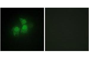 Immunofluorescence analysis of HepG2 cells, using IPPK Antibody. (IPPK 抗体  (AA 11-60))