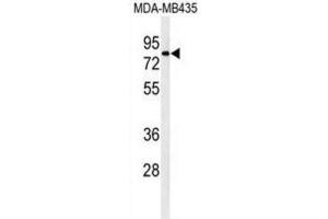 Western Blotting (WB) image for anti-ATH1, Acid Trehalase-Like 1 (ATHL1) antibody (ABIN3002191) (ATHL1 抗体)