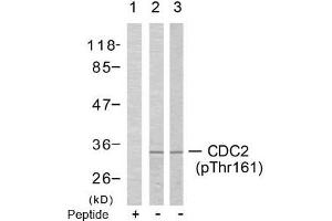 Image no. 2 for anti-Cyclin-Dependent Kinase 1 (CDK1) (pThr161) antibody (ABIN196846) (CDK1 抗体  (pThr161))