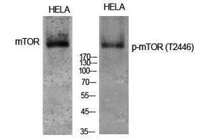 Western Blotting (WB) image for anti-Mechanistic Target of Rapamycin (serine/threonine Kinase) (mTOR) (pThr2446) antibody (ABIN3182280) (MTOR 抗体  (pThr2446))