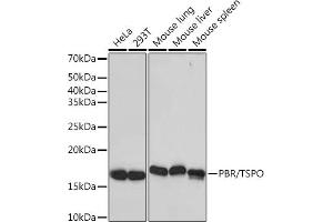 Western blot analysis of extracts of various cell lines, using PBR/TSPO Rabbit mAb (ABIN1679051, ABIN3019258, ABIN3019259 and ABIN7101738) at 1:1000 dilution. (TSPO 抗体)