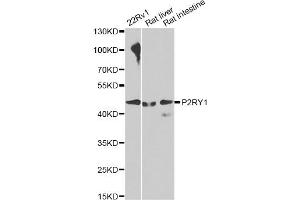 Western blot analysis of extracts of various cell lines, using P2RY1 antibody. (P2RY1 抗体)
