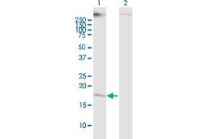 Western Blot analysis of CMTM5 expression in transfected 293T cell line ( H00116173-T01 ) by CMTM5 MaxPab polyclonal antibody. (CMTM5 抗体  (AA 1-156))