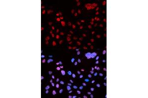 Immunofluorescence analysis of U2OS cell using Phospho-TP53-S9 antibody. (p53 抗体  (pSer9))