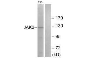 Western blot analysis of extracts from 293 cells, treated with etoposide (25uM, 24hours), using JAK2 (Ab-570) antibody. (JAK2 抗体  (Tyr570))