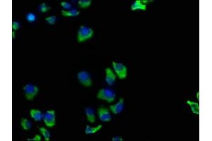 Immunofluorescence staining of Hela cells with ABIN7173872 at 1:100, counter-stained with DAPI. (TNFRSF1A 抗体  (AA 249-455))