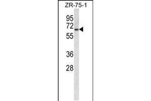 Western blot analysis in ZR-75-1 cell line lysates (35ug/lane). (GPD2 抗体  (C-Term))