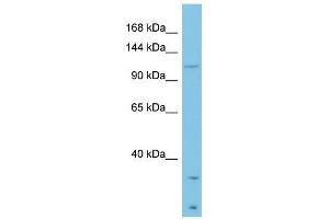 Laminin Beta 3 antibody used at 1 ug/ml to detect target protein. (Laminin beta 3 抗体  (Middle Region))